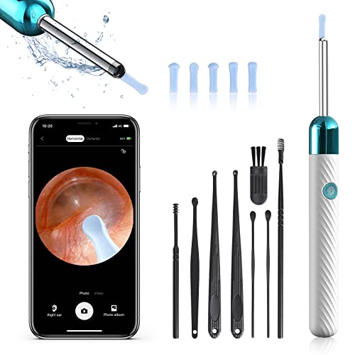 Ear Wax Removal Kit with Camera 1080P Otoscope Light 6 Ear Pick Blue O7018