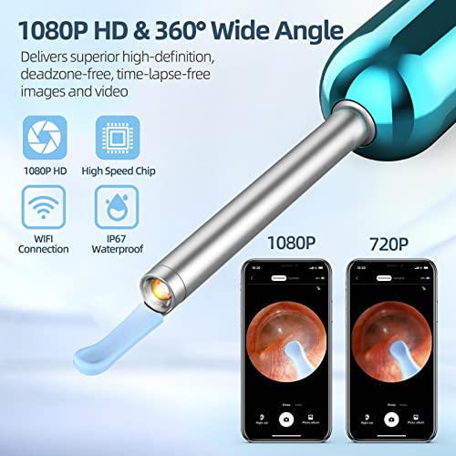Ear Wax Removal Kit with Camera 1080P Otoscope Light 6 Ear Pick Blue O7018