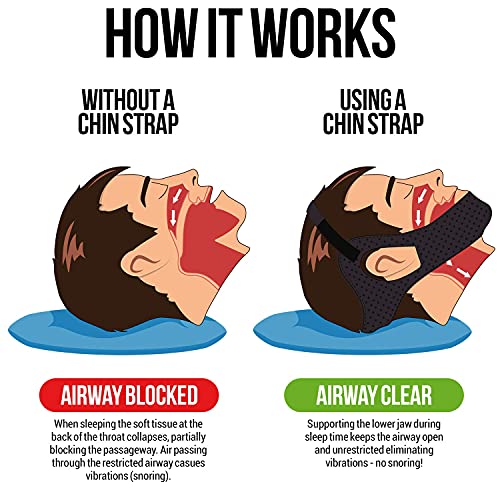 Anti Snoring Chin Strap, Large, Adjustable C25686