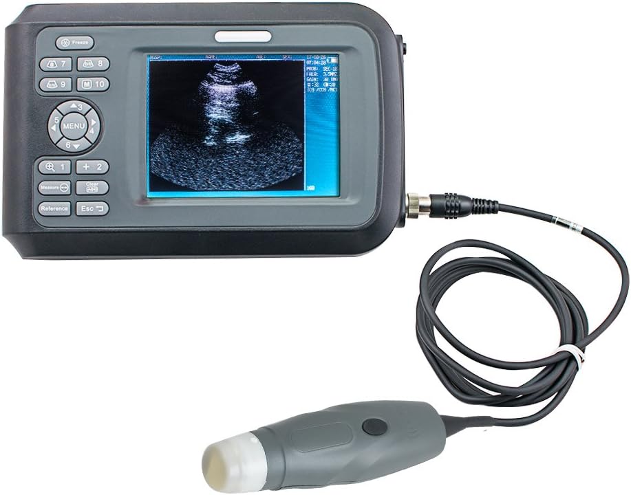 Portable Handheld Ultrasound Scanner with 3.5MHz Mechanical Sector Probe Z715